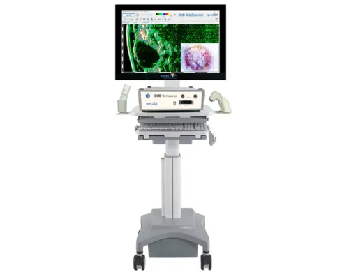 High frequency ultrasound skin scanner 4260750040046_dub skin scanner and trolley
