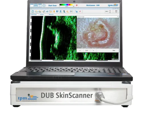Multi Frequency Ultrasound Skin Scanner