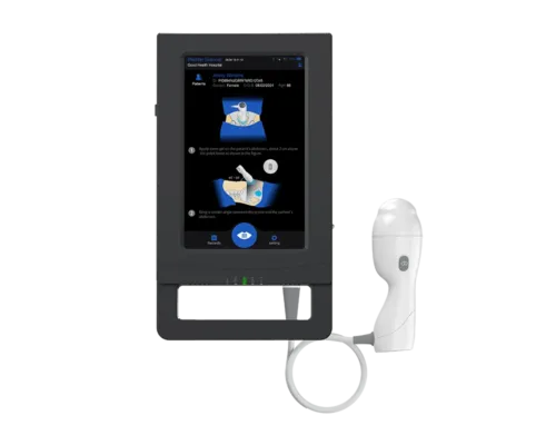 Portable 3D bladder scanner front view showing 10.3-inch touchscreen interface with 3D ultrasound probe for bladder volume measurement